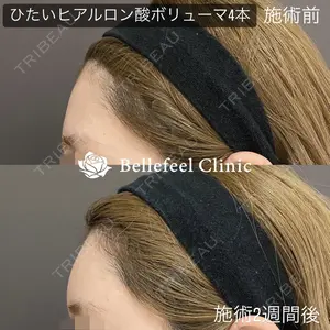 Bellefeel Clinic 代官山 兵藤 秀忠 医師の症例