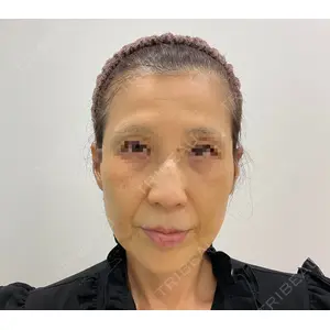 ユウコ形成外科クリニック 植田　有子医師の症例