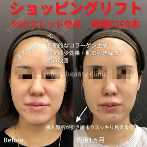 ロレシー美容クリニック 心斎橋駅前院 福留院長医師の症例