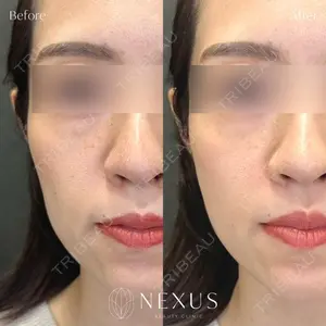 NEXUS CLINICの症例