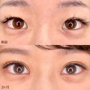 東京シンデレラ美容外科 池袋院の症例