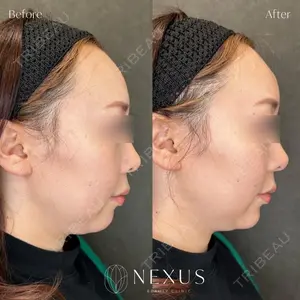 NEXUS CLINICの症例