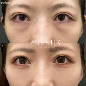 NEXUS CLINICの症例
