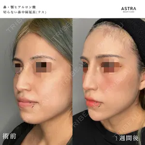 ASTRA BEAUTY CLINIC 塩満 惠子医師の症例