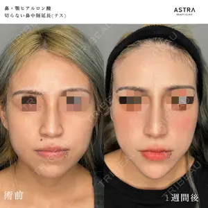 ASTRA BEAUTY CLINIC 塩満 惠子医師の症例