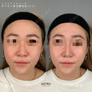 ASTRA BEAUTY CLINIC 塩満 惠子医師の症例