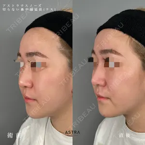ASTRA BEAUTY CLINIC 塩満 惠子医師の症例