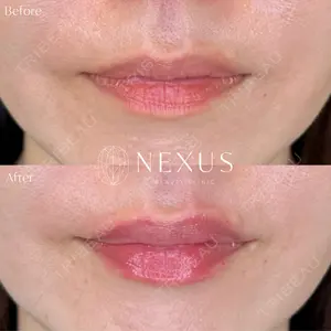 NEXUS CLINICの症例