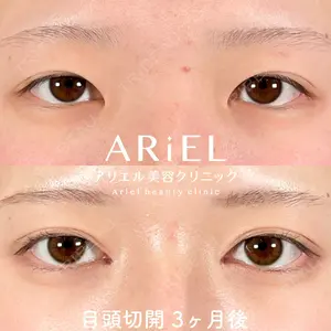 アリエル美容クリニック 大宮院 鈴木　桂介医師の症例