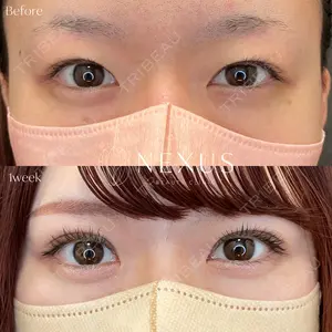 NEXUS CLINIC 酒井　知子医師の症例
