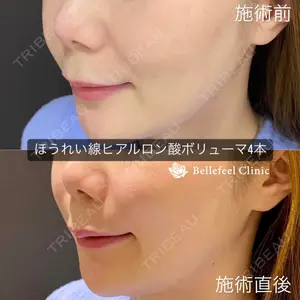 Bellefeel Clinic 代官山 兵藤 秀忠 医師の症例