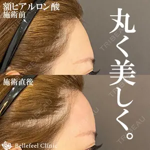 Bellefeel Clinic 代官山 兵藤 秀忠 医師の症例