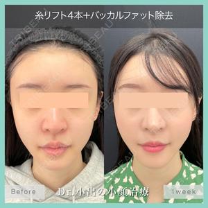 東京シンデレラ美容外科 池袋院の症例