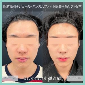 東京シンデレラ美容外科 池袋院の症例