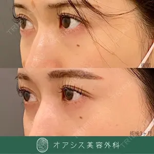 オアシス美容外科 遠藤 剛史医師の症例