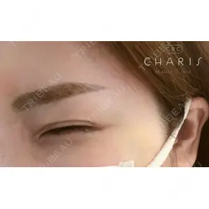 CHARIS BEAUTY CLINICの症例