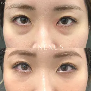 NEXUS CLINICの症例