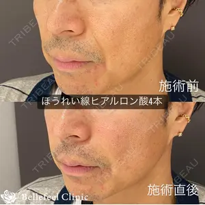 Bellefeel Clinic 代官山 兵藤 秀忠 医師の症例