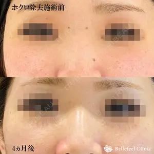 Bellefeel Clinic 代官山 兵藤 秀忠 医師の症例
