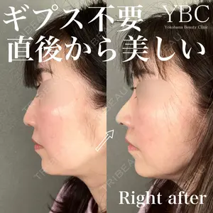 YBC横浜美容外科 池袋院 磯村 亮輔医師の症例