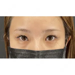 HAAB×DREAM BEAUTY CLINIC 大阪梅田院 鈴木 馨斗医師の症例