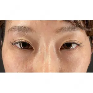 HAAB×DREAM BEAUTY CLINIC 大阪梅田院 鈴木 馨斗医師の症例