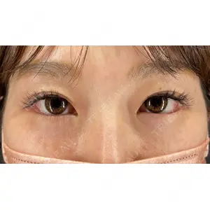 HAAB×DREAM BEAUTY CLINIC 大阪梅田院 鈴木 馨斗医師の症例