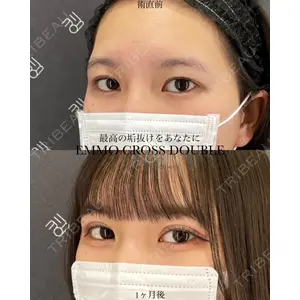 EMMO FACE CLINIC 大宮院 廣松 直樹医師の症例