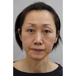 セオリークリニック 筒井　裕介医師の症例