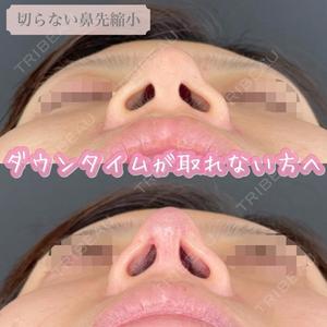 ルラ美容クリニック 渋谷本院の症例