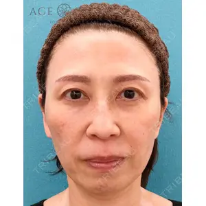 エースクリニック 名古屋院 芹澤 快医師の症例