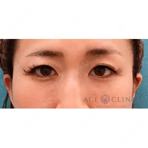 エースクリニック 大阪梅田HEPナビオ院の症例