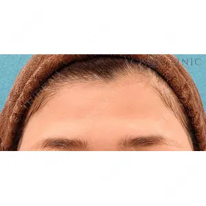 エースクリニック 大阪梅田HEPナビオ院の症例