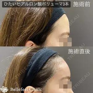 Bellefeel Clinic 代官山 兵藤 秀忠 医師の症例