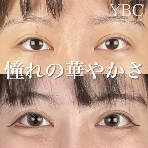 YBC横浜美容外科 大宮院 磯村 亮輔医師の症例