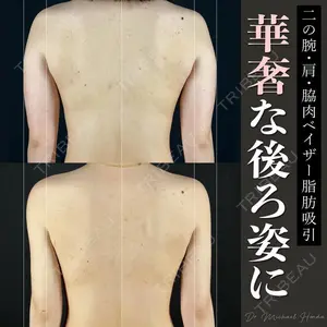 MYCLI【マイクリ】 本田マイケル武史医師の症例