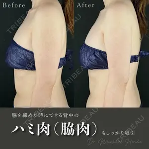 MYCLI【マイクリ】 本田マイケル武史医師の症例