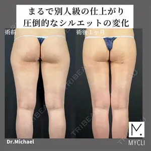 MYCLI【マイクリ】 本田マイケル武史医師の症例