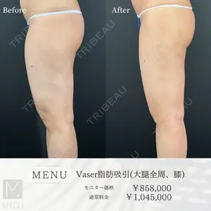 MYCLI【マイクリ】 本田マイケル武史医師の症例