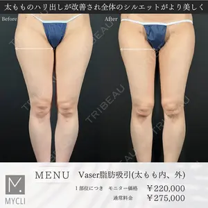 MYCLI【マイクリ】 本田マイケル武史医師の症例
