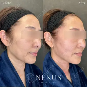 NEXUS CLINICの症例