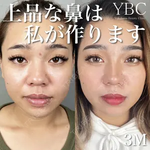 YBC横浜美容外科 池袋院 磯村 亮輔医師の症例