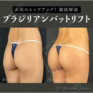 MYCLI【マイクリ】 本田マイケル武史医師の症例