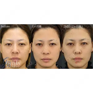 銀座美容外科クリニック 銀座院の症例
