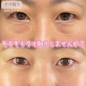 ルラ美容クリニック 札幌大通り院の症例