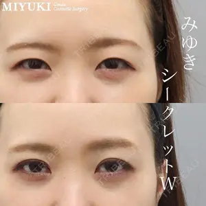 銀座みゆき通り美容外科 大阪梅田院 岩井謙治医師の症例