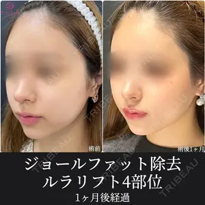 ルラ美容クリニック 大阪心斎橋院 藤川 一朗医師の症例