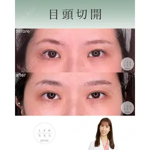 くさのたろうクリニック 立雅恵医師の症例