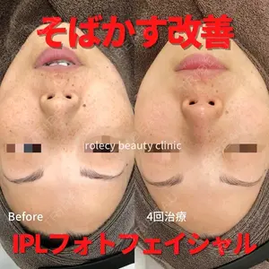 ロレシー美容クリニック 心斎橋駅前院 福留院長医師の症例