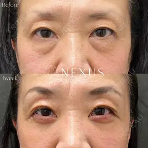 NEXUS CLINICの症例